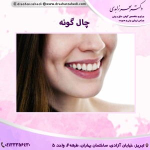 چال گونه