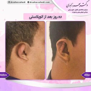 جراحی گوش