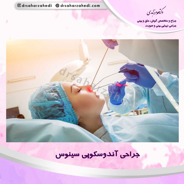 جراحی آندوسکوپی سینوس
