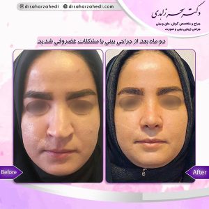 جراح بینی در تبریز