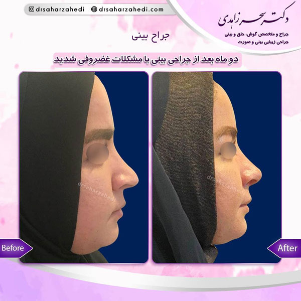 جراح بینی در تبریز