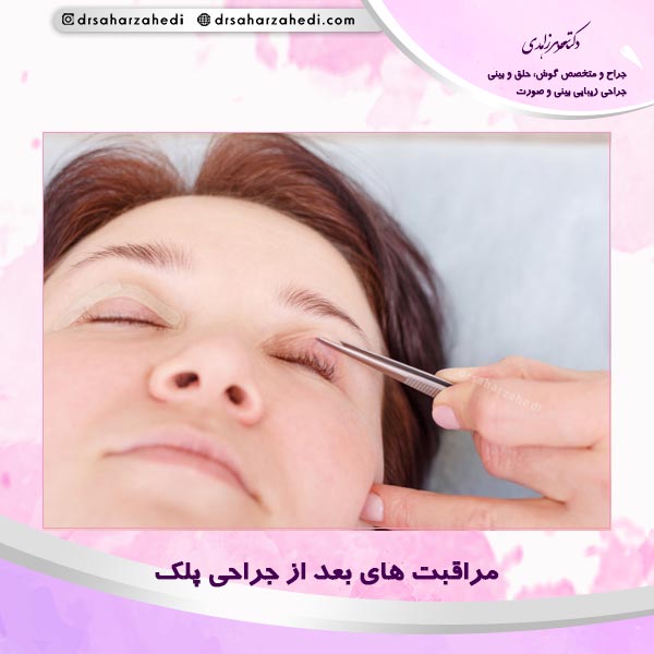 مراقبت های بعد از جراحی پلک