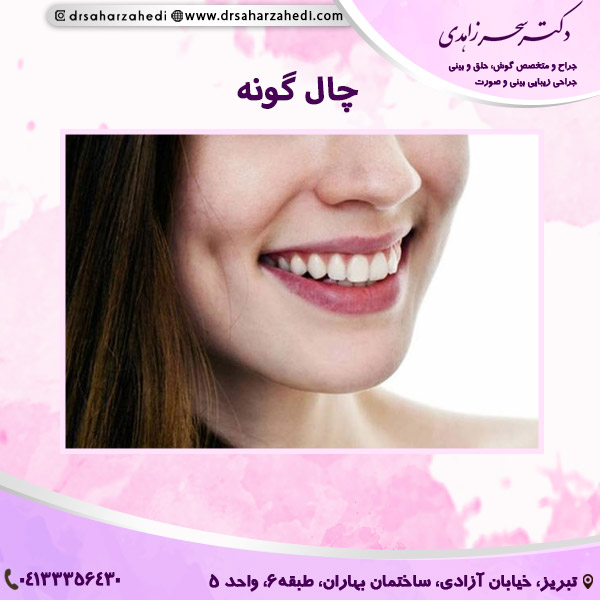 چال گونه