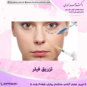 تزریق فیلر