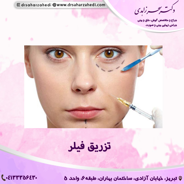 تزریق فیلر