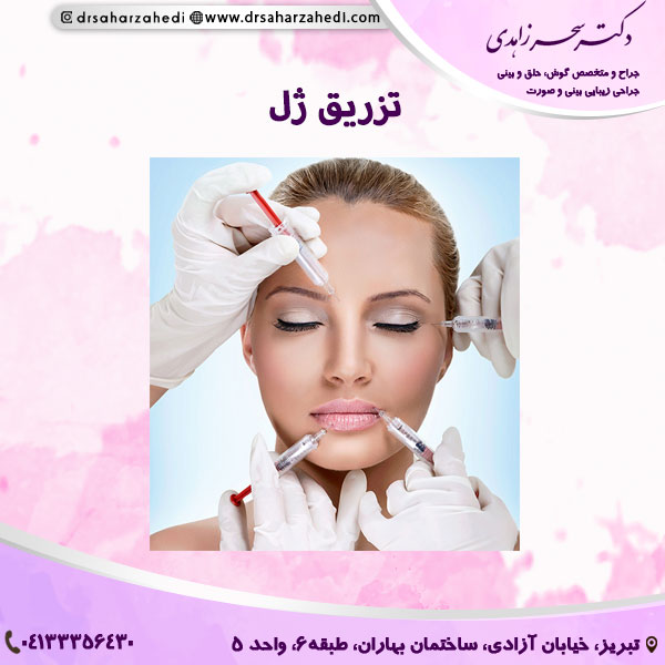 تزریق ژل