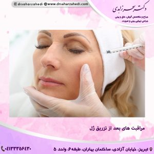 مراقبت های بعد از تزریق ژل
