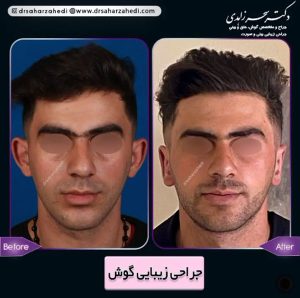 جراحی گوش