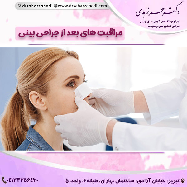 مراقبت های بعد از جراحی بینی https://drsaharzahedi.com/