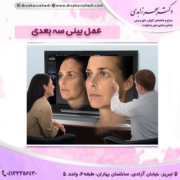 عمل بینی سه بعدی https://drsaharzahedi.com/