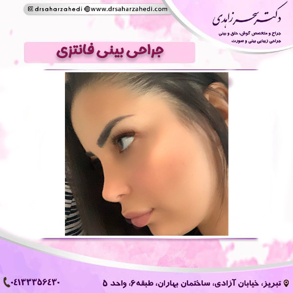 جراحی بینی فانتزی https://drsaharzahedi.com/
