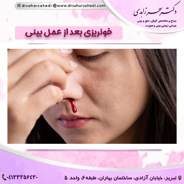خونریزی بعد از عمل بینی