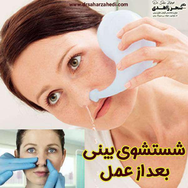 شستشوی بینی بعد از عمل - دکتر سحر زاهدی