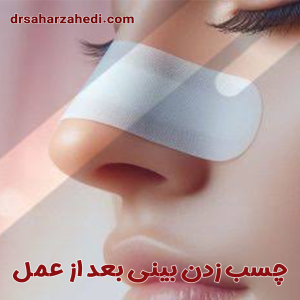 چسب زدن بینی بعد از عمل