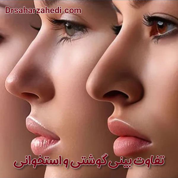 تفاوت بینی گوشتی و استخوانی