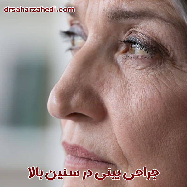 جراحی بینی در سنین بالا