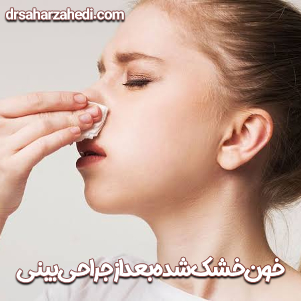 خون خشک شده بعد از جراحی بینی
